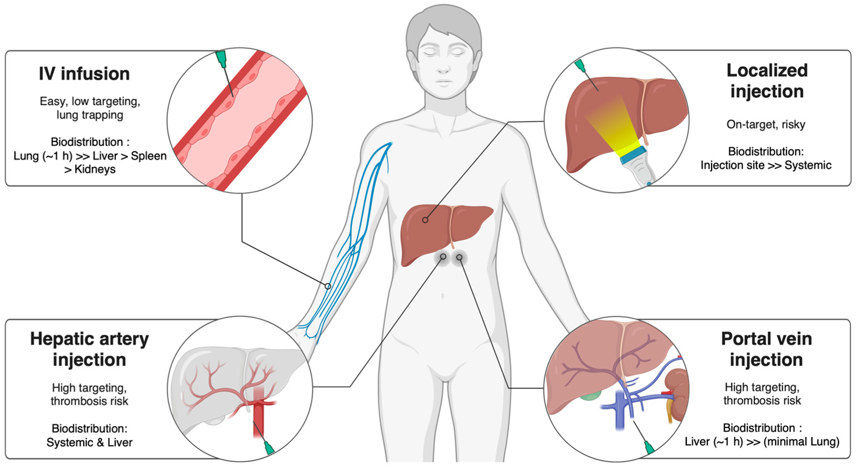 圖2：MSCs和EVs在肝病治療中的遞送途徑。生物分布和治療效果會受到給藥途徑的影響，例如靜脈注射、門靜脈注射、肝動脈注射或局部注射。