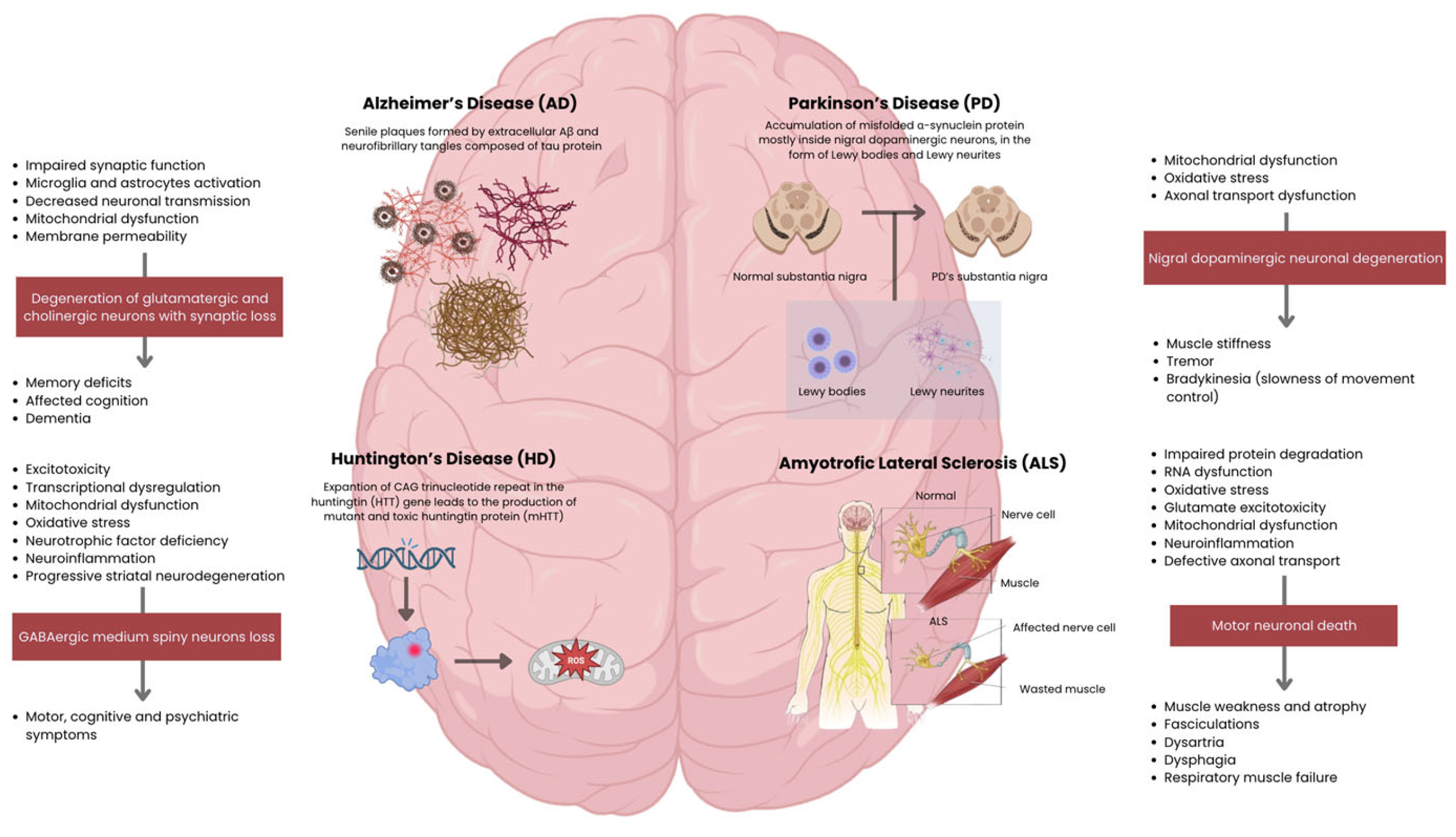 圖2：主要神經退行性疾病的病理生理機制和臨床特征。側邊欄概述了從細胞功能障礙到特定神經元丟失以及隨后的臨床表現的進展過程。