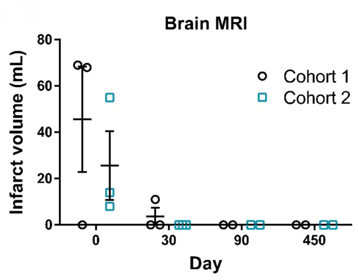 圖3:腦部MRI梗死體積測量。代表性MRI圖像顯示了患者從篩查到第450天的腦梗死體積。圖中顯示了患者在篩查(第0天)、治療后(第30天和第90天)以及隨訪(第450天)時的梗死體積。 圖3:腦部MRI梗死體積測量。代表性MRI圖像顯示了患者從篩查到第450天的腦梗死體積。圖中顯示了患者在篩查(第0天)、治療后(第30天和第90天)以及隨訪(第450天)時的梗死體積。