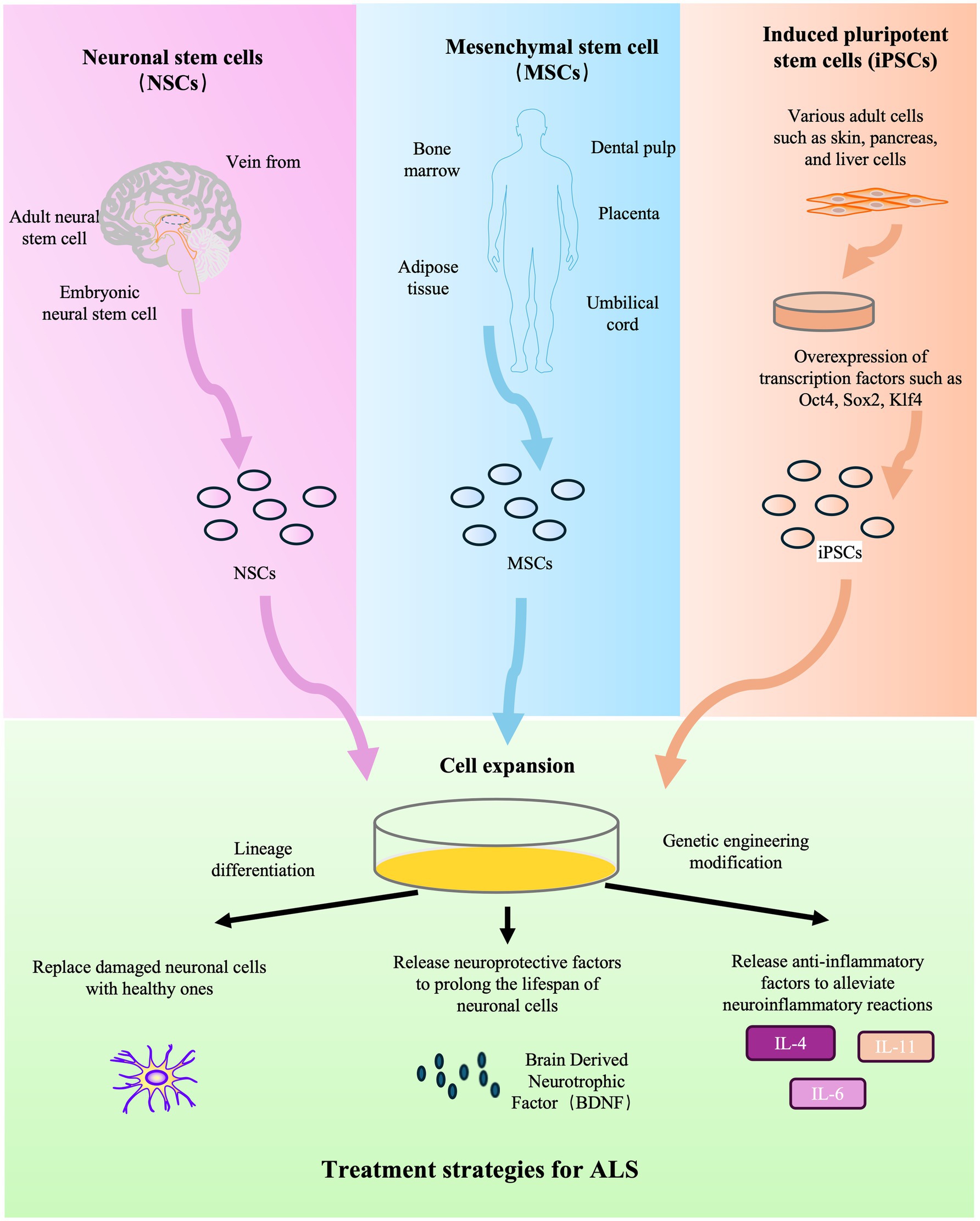 圖2:干細胞療法治療ALS的示意圖。 圖2:干細胞療法治療ALS的示意圖。