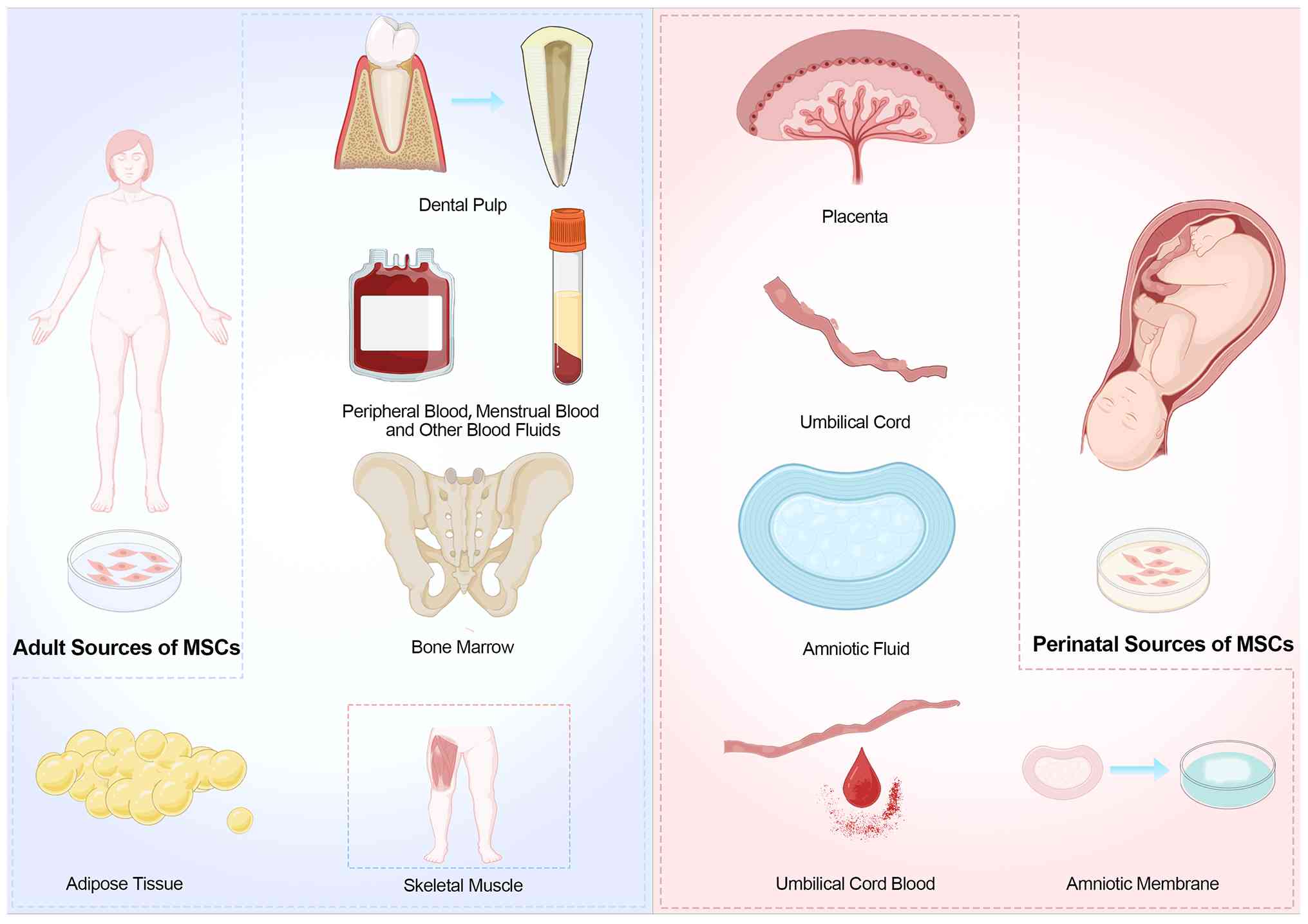 圖2:間充質干細胞的來源。成人間充質干細胞可來源于骨髓、脂肪組織、外周血、骨骼肌和牙髓。圍產(chǎn)期間充質干細胞通常取自胎盤、臍帶、臍帶血、羊水和羊膜。 圖2:間充質干細胞的來源。成人間充質干細胞可來源于骨髓、脂肪組織、外周血、骨骼肌和牙髓。圍產(chǎn)期間充質干細胞通常取自胎盤、臍帶、臍帶血、羊水和羊膜。